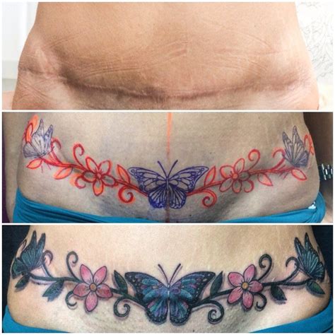 best tummy tuck cover up tattoos|11+ Tummy Tuck Cover